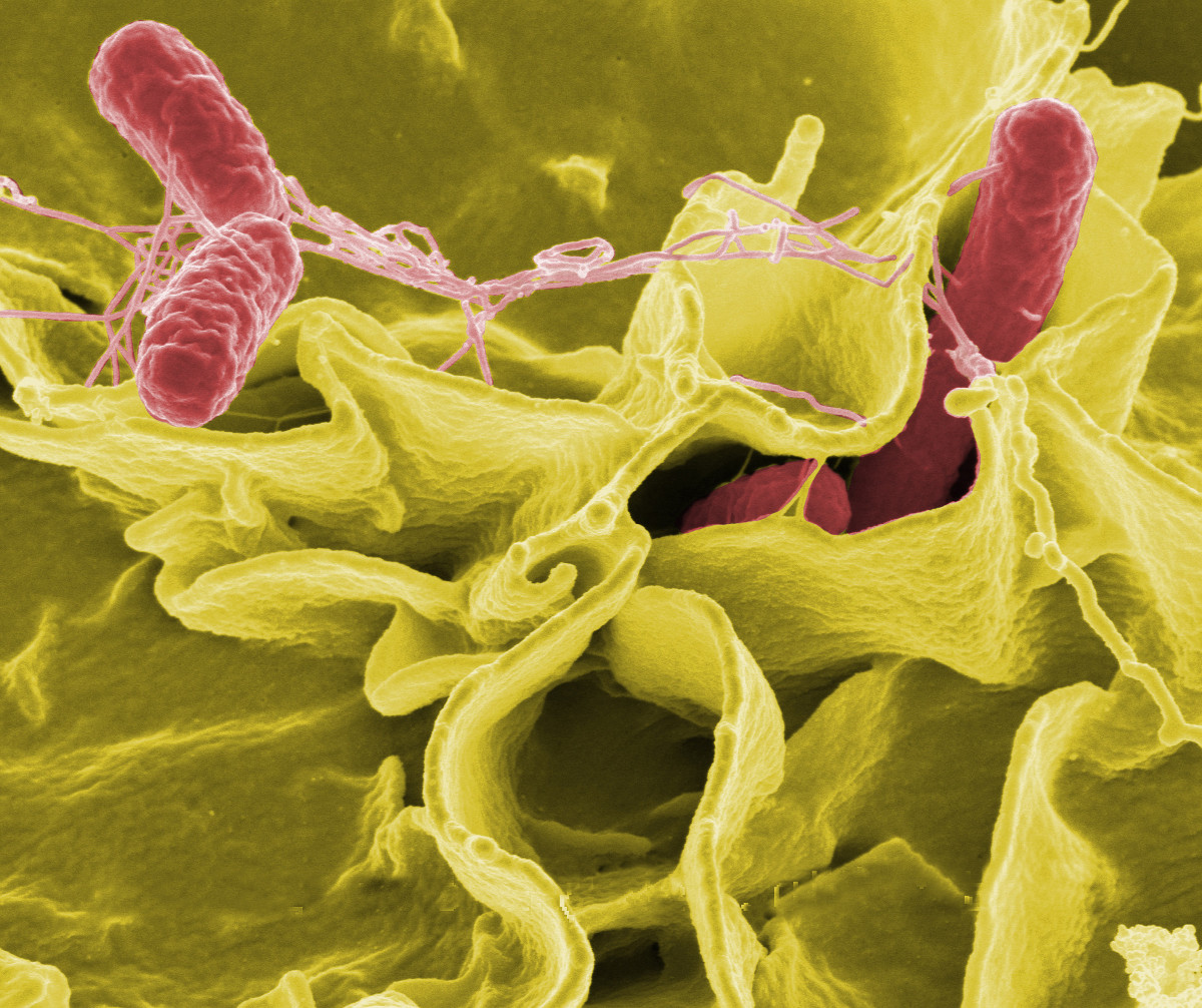 Bacterias y virus transmitidos por roedores